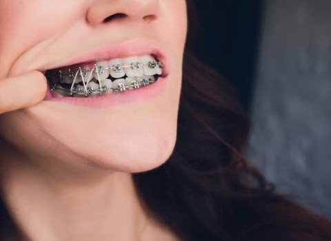 تصویر 1 از خرید و قیمت الاستیک ارتودنسی + فروش عمده
